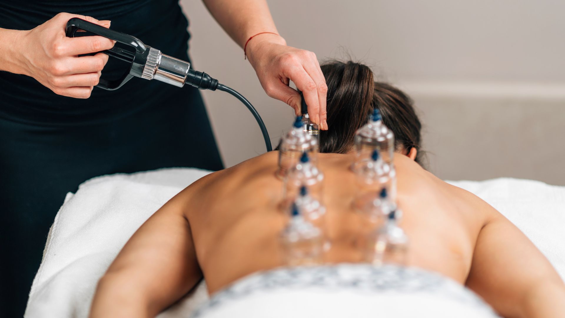 Cupping therapy treatment with glass cups on person's back